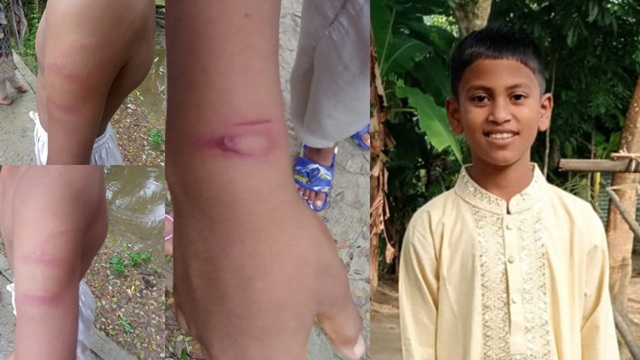 সখিপুরে মাদ্রাসায় পড়া না পারায় শিক্ষার্থীকে পিটিয়ে আহত করলেন শিক্ষক কামরুজ্জামান
